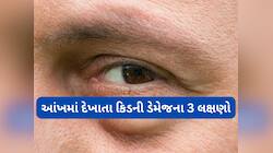 કિડની ખરાબ થાય ત્યારે આંખમાં થાય છે આ તકલીફો, આંખ પર ધ્યાન નહીં આપો તો કિડની પતી જશે