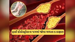 કોલેસ્ટ્રોલ વધવા લાગે તે પહેલા પગમાં જોવા મળે છે આ 5 લક્ષણ, ભૂલેચૂકે નજરઅંદાજ ન કરતા