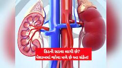 કિડની સડવા લાગે ત્યારે પેશાબમાં જોવા મળે છે આ 3 સંકેત! બિલકુલ અવગણતા નહીં