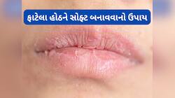 Dry Lips: ફાટેલા હોઠ એક દિવસમાં થઈ જશે સોફ્ટ, આ રીતે લગાડો દૂધ અને ગુલાબના પાન
