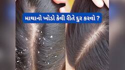 Dandruff: એક વારમાં દૂર થઈ જશે માથાનો ખોડો, આ સફેદ વસ્તુનો કરો ઉપયોગ