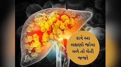 રાત્રે જ જોવા મળે છે લિવર ડેમેજના આ ત્રણ લક્ષણો, અવગણના કરી તો ભૂલ ભારે પડશે