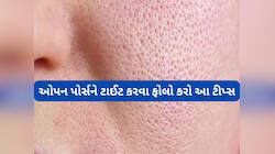 ઓપન પોર્સ બંધ કરવા કરો આ સરળ કામ, આ વસ્તુ યુઝ કર્યા પછી સ્કિન એકદમ ક્લીયર દેખાશે