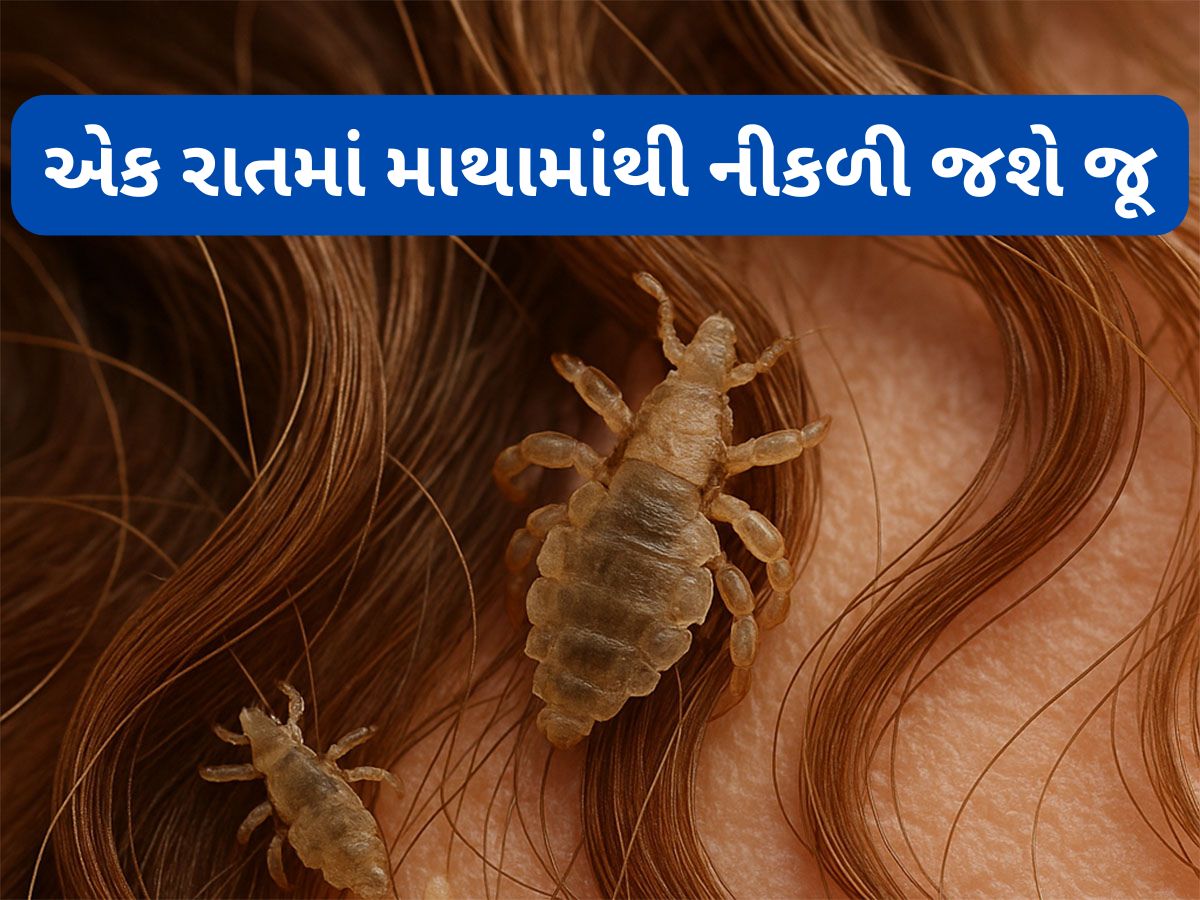 Head Lice: એક રાતમાં નીકળી જશે માથામાંથી જૂ, અજમાવી જુઓ નાળિયેર તેલનો આ નુસખો Head Lice: એક રાતમાં નીકળી જશે માથામાંથી જૂ, અજમાવી જુઓ નાળિયેર તેલનો આ નુસખો
