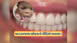 આઠમી અજાયબી! 32 નહીં આ છોકરાના મોઢામાં છે પુરા 94 દાંત, જુઓ વાયરલ વીડિયો