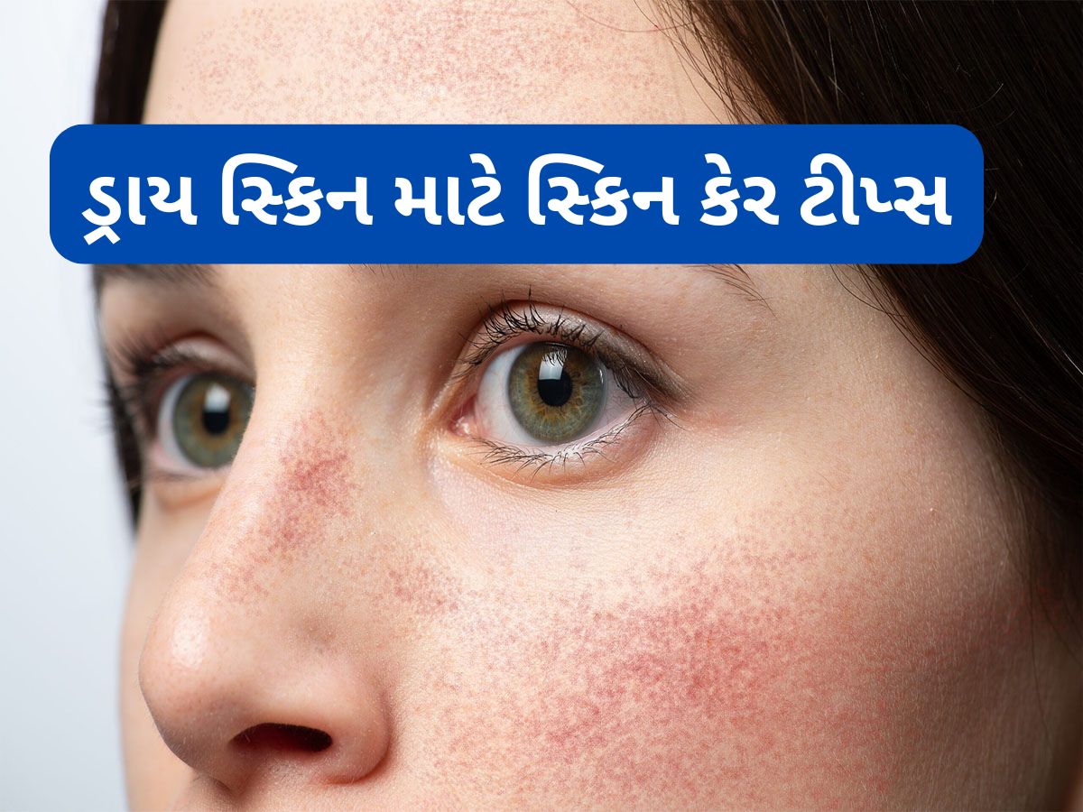 Dry Skin: ઠંડીના કારણે ગાલ ફાટે તો આ વસ્તુ લગાડજો, એક દિવસમાં સ્કિન થઈ જશે સોફ્ટ Dry Skin: ઠંડીના કારણે ગાલ ફાટે તો આ વસ્તુ લગાડજો, એક દિવસમાં સ્કિન થઈ જશે સોફ્ટ