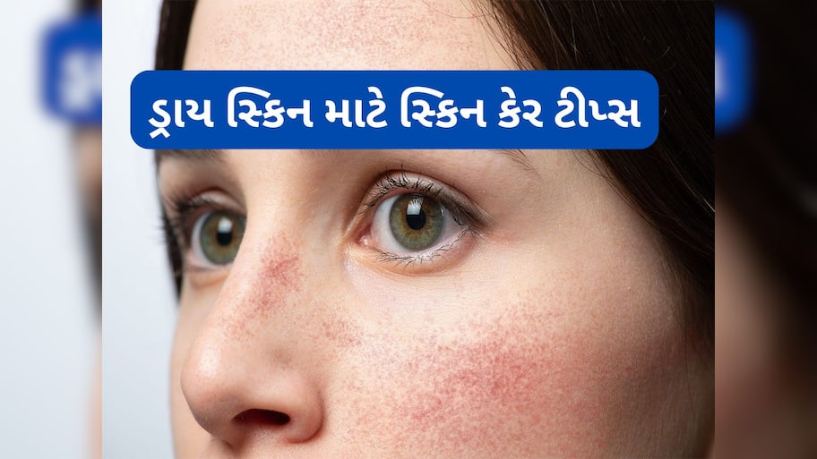 Dry Skin: ઠંડીના કારણે ગાલ ફાટે તો આ વસ્તુ લગાડજો, એક દિવસમાં સ્કિન થઈ જશે સોફ્ટ