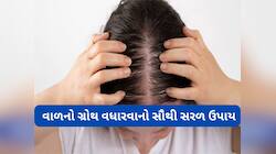 Hair Growth: ખરેલા વાળની જગ્યાએ ઉગવા લાગશે વાળ, આ રીતે નાળિયેર તેલનો કરજો ઉપયોગ