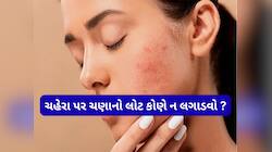 ચણાના લોટથી સ્કિનને થઈ શકે છે નુકસાન, જાણો કોણે સ્કિન કેરમાં ચણાનો લોટ યુઝ ન કરવો