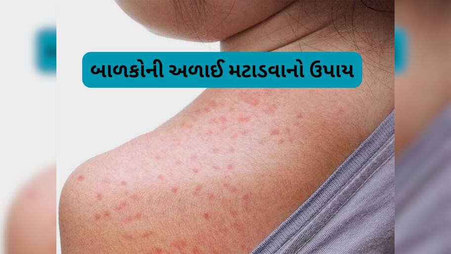 Heat Rashes In Children during summer | Prickly Heat Home Remedies ...