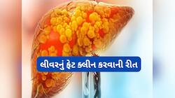 રુટીનમાં 5 સરળ ફેરફાર કરી લો, ફેટી લીવર ક્યારેય નહીં થાય અને હશે તો રિવર્સ થઈ જશે