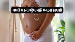 પ્રેગ્નન્સી સાથે આ 4 કંડીશન હોય તો શરીર પર વધારે પ્રમાણમાં દેખાય સ્ટ્રેચ માર્ક્સ