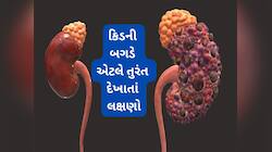 Kidney : કિડની ખરાબ થાય એટલે શરીરમાં શરુ થઈ જાય ફેરફાર, શરુઆત થાય આ 4 તકલીફો થવાથી