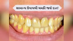 મોતીની જેમ ચમકી જશે પીળા દાંત, ઘરે જ તૈયાર કરો આ દેશી મંજન