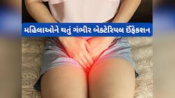 આ 5 ફેરફારને ગરમીની સામાન્ય સમસ્યા ન સમજો, મૂત્રમાર્ગની ગંભીર બીમારીનું લક્ષણ પણ હોય