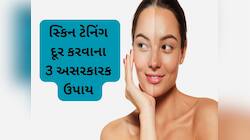 તડકાના કારણે કાળી થયેલી સ્કિનને રુપાળી કરવાની રીત, ઉનાળામાં ખૂબ કામ લાગશે આ ઉપાય