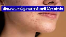 ફેસ પર વારંવાર ફોડલીઓ થતી હોય તો લીમડાના પાનની પેસ્ટ લગાડો, સ્કિન થઈ જશે એકદમ ક્લીયર
