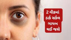 ડાર્ક સર્કલ દુર કરવા યુઝ કરો આમાંથી કોઈ 1 આઈ માસ્ક, 2 વીકમાં કાળા કુંડાળા ગાયબ હશે