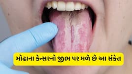મોઢાનું કેન્સર થાય તો જીભ પર જોવા મળે છે આ લક્ષણ, પ્રથમ સ્ટેજથી લઈને અંતિમ સ્ટેજ