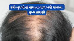 હેર લોસ અને હેર ફોલમાં ફરક હોય, અચાનક વધારે વાળ ખરી જવાનું કારણ હોય શકે આ સમસ્યાઓ
