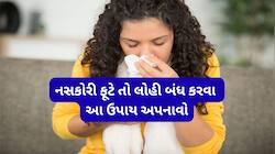 ગરમીમાં નસકોરી ફૂટે તો સૌથી પહેલા આ કામ કરવું, નાકમાંથી લોહી નીકળતું તુરંત બંધ થશે