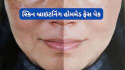 લૂના કારણે સ્કિન પર દેખાતી ડલનેસ દુર કરો, હળદરમાં આ વસ્તુ મિક્સ કરી ચહેરા પર લગાડો