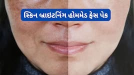 લૂના કારણે સ્કિન પર દેખાતી ડલનેસ દુર કરો, હળદરમાં આ વસ્તુ મિક્સ કરી ચહેરા પર લગાડો