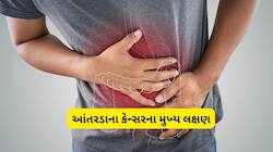 આંતરડાના કેન્સરથી બચવું હોય તો આજથી જ શરૂ કરી દો આ 5 કામ, ડોક્ટરે આપી સલાહ