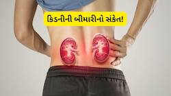 કિડની ફેલ થઈ જશે તો પણ ખબર નહીં પડે, ડોક્ટરે કહ્યું- આ વાતનું રાખો ધ્યાન