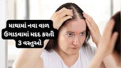 માથામાં ટાલ પડી જાય તે પહેલા કરવા લાગો આ 3 કામ, માથામાં ઉગવા લાગશે નવા વાળ