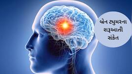 World Brain Tumour Day: બ્રેન ટ્યુમરના 5 શરૂઆતી લક્ષણ, નજરઅંદાજ કરશો તો ભારે પડશે