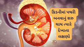 પેશાબમાં બળતરા સહિતના આ 5 લક્ષણો જણાવે કિડનીમાં બની રહી છે પથરી, આ રીતે ઓપરેશનથી બચો