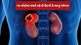 કિડની કેન્સર યુવાનો માટે મોટી સમસ્યા બન્યું, તમારી એક આદત વધારે છે બમણું જોખમ