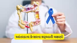 મસા સમજી નજરઅંદાજ ન કરો, હોઈ શકે છે આંતરડાના કેન્સરનો સંકેત, જાણો કેવા હોય છે લક્ષણ