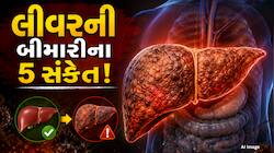 સમયસર ઓળખો લીવરની તકલીફ, આ 5 સંકેત જોવા મળે તો તરત સાવધાન થાઓ