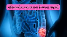 મહિલાઓમાં કોલન કેન્સરના શરૂઆતી લક્ષણો: અવગણના કરવી પડી શકે છે ભારે