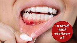 સાવધાન! પેઢાના કેન્સરના શરૂઆતી લક્ષણો કયા છે? ભૂલથી પણ નજરઅંદાજ ન કરતા આ સંકેતો!