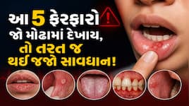 તંબાકુ નથી ખાતા તો પણ થઈ શકે છે મોઢાનું કેન્સર! ડૉક્ટરે જણાવ્યા લક્ષણો