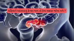આંતરડાના કેન્સરમાં મહિલાઓમાં જોવા મળતાં લક્ષણો, ખોરાકમાં ઓછું ફાઈબર ઘાતક સાબિત થશે