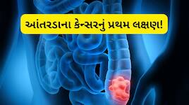 મોટા આંતરડાના કેન્સરના લક્ષણો શું છે? આ 2 Symptoms દેખાય તો તરત જ ડૉક્ટરને મળવું