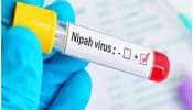 ફરી મહામારીનો ખતરો? નિપાહ વાયરસને કારણે આ જગ્યાએ લાગ્યા કડક પ્રતિબંધો