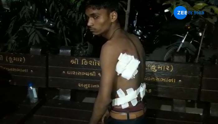 PICS સુરત: નજીવી બાબતે ધોરણ 12ના વિદ્યાર્થી પર ચપ્પાથી જીવલેણ હુમલો