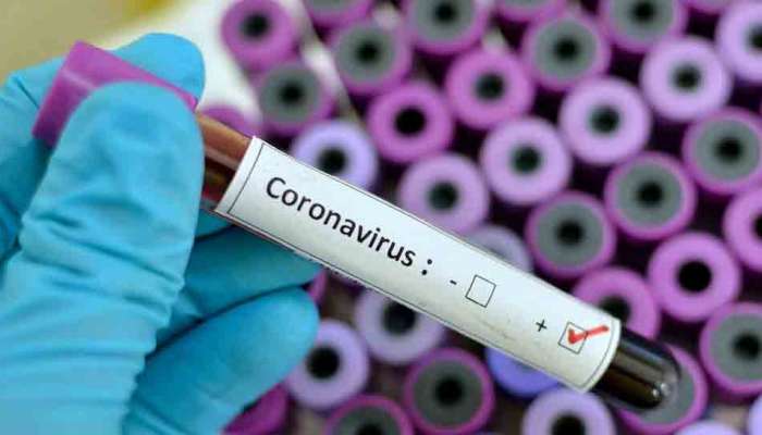 કોરોનાની રસીનું પહેલીવાર થયું પરીક્ષણ, પરિણામ આવતા લાગશે આટલો સમય 