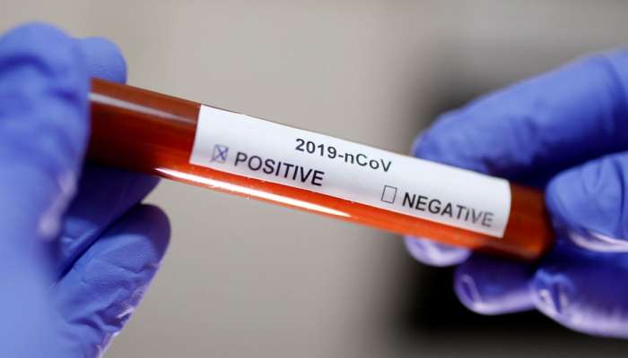Coronavirus UPDATES: મુંબઇમાં કોરોના સંક્રમણથી વધુ એક મોત, ભારતમાં અત્યાર સુધી 8 લોકોના મોત