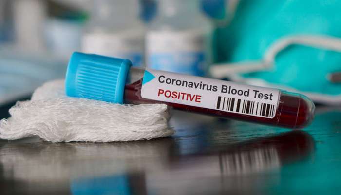 કોરોનાની રસી વિકસાવવા માટે આ ભારતીય કંપની લેશે ઓસ્ટ્રેલિયન યુનિવર્સિટીની મદદ
