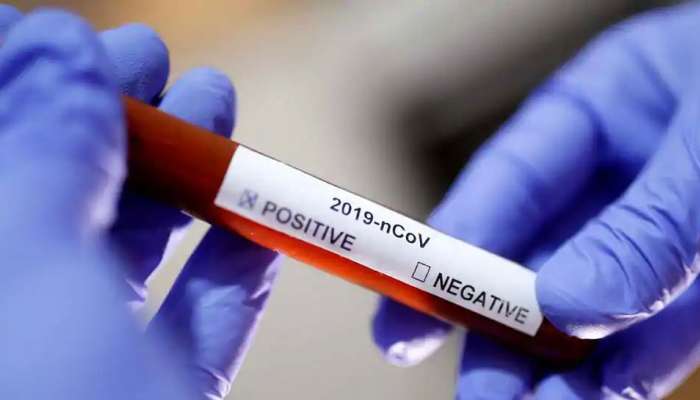 Coronavirus: સુરતમાં 45 કોરોના પોઝિટિવ કેસ, વલસાડમાં 2 કેસ નોંધાયા