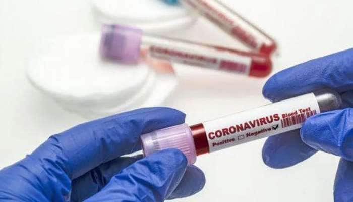Coronavirus: વડોદરા, સુરત સહિત આ શહેરોમાં જાણો આજે કેટલા નોંધાયા કોરોનાના કેસ