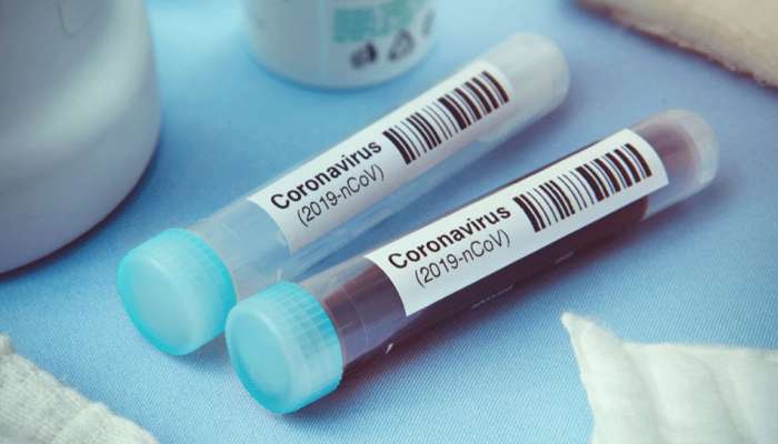 Corona Test: ખાનગી હોસ્પિટલો હવે મનફાવે તેમ નહીં વસૂલી શકે પૈસા, સરકાર લઈ શકે છે આ નિર્ણય