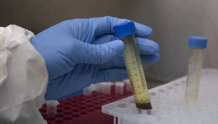 Coronavirus: ભારતની પ્રથમ કોવિડ-19 દર્દીને ફરી થયો કોરોના, અધિકારીઓએ કહ્યું- ચિંતાની વાત નથી