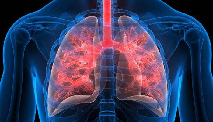 Harmful Food For Lungs: આ 5 વસ્તુઓ ફેફસાંને કરી દેશે ખરાબ, જલ્દી જાણી લો આ વાત